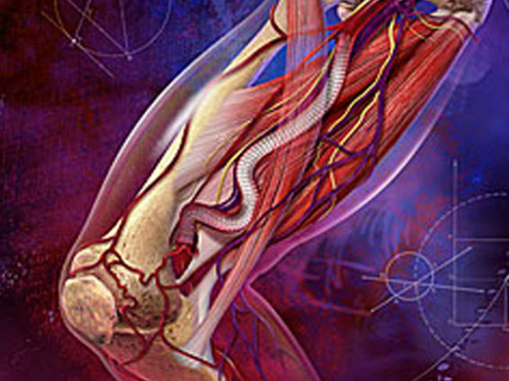 VASCULAR GRAFTS,PATCHES, PERICARDIAL MEMBRANES,SUTURES